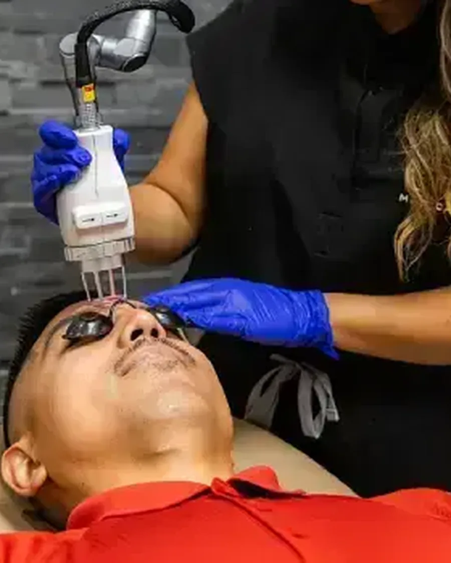 HydraFacial and skin resurfacing at EVO Medical Spa